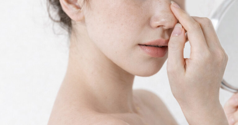 レチノールは鼻の毛穴に効く？黒ずみ・開き毛穴・A反応まで徹底解説